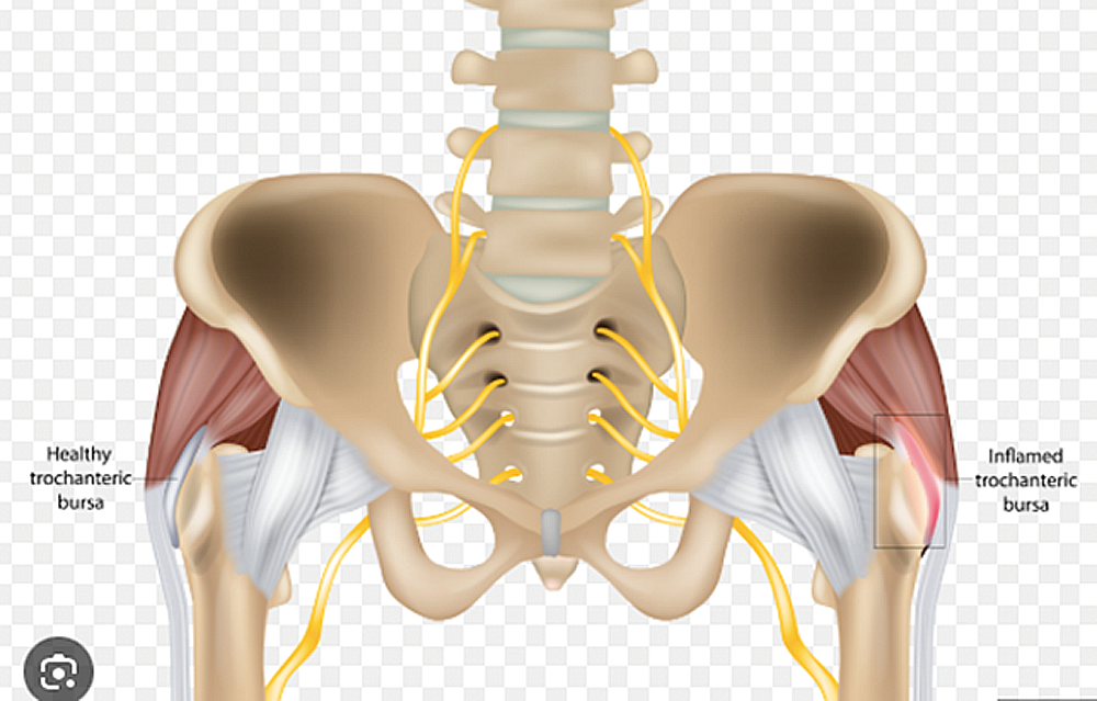 Trochanter